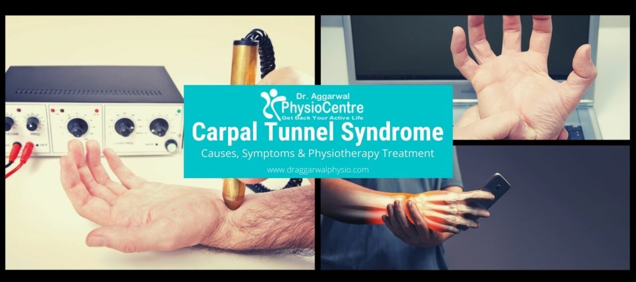 Carpal Tunnel Syndrome Physiotherapy Treatment In Noida Dr Aggarwal