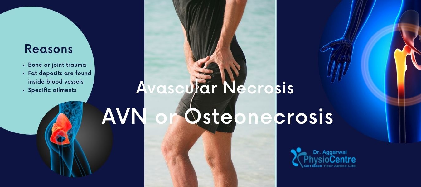 Non-Surgical Treatment for Avascular Necrosis of Hip Treatment in Noida